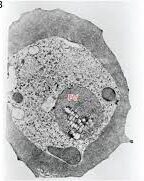 Magnified image on slide of hemozoin, which is a byproduct generated by blood-feeding parasites, including the species that causes malaria.